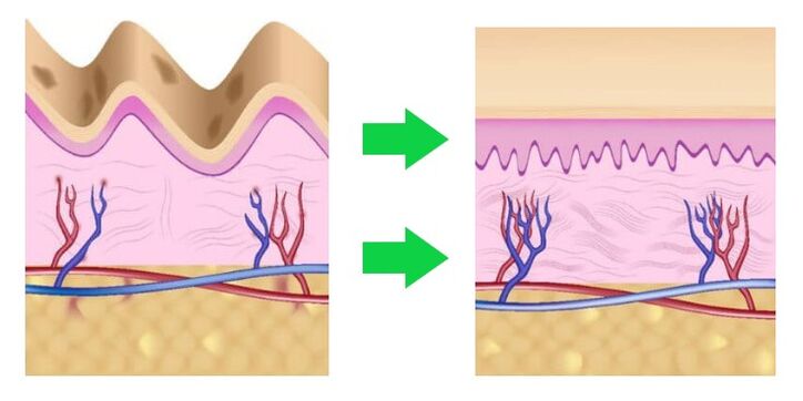 Intenskin adjusts the skin