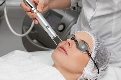 the benefits of laser resurfacing